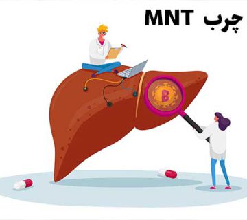 MNT کبد چرب