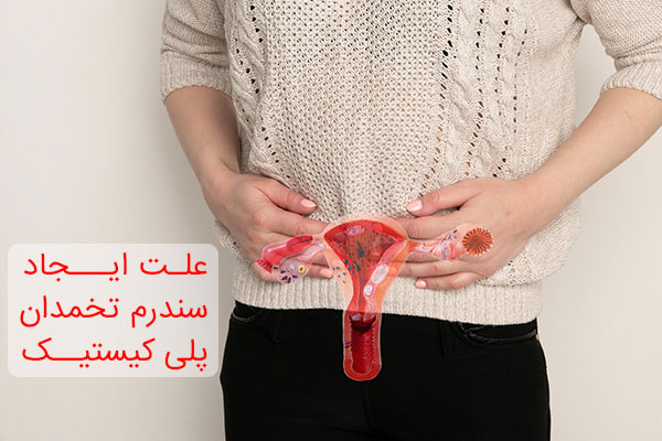 علت ایجاد سندرم تخمدان پلی کیستیک